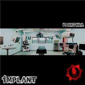 IMPLΛNT - Fraktura download free